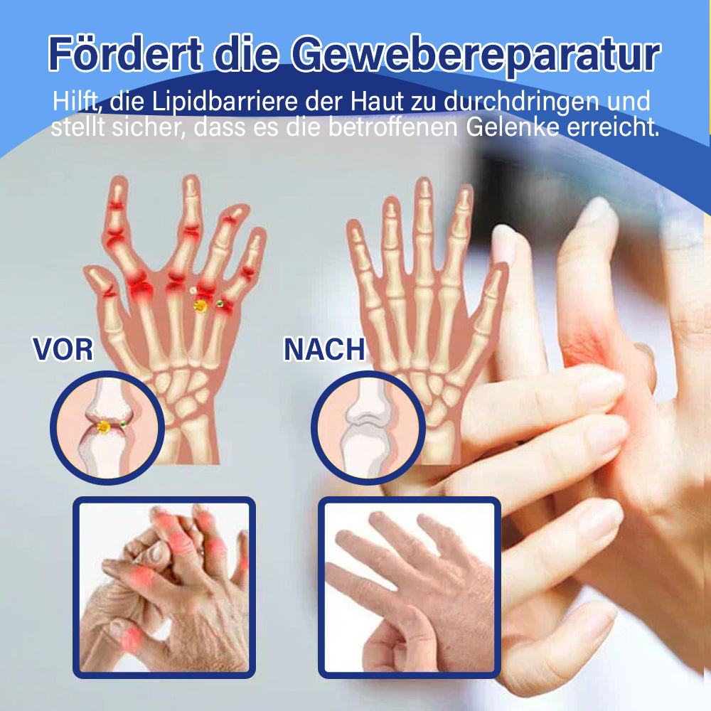 ✅Offizieller Shop: flysmus™ Lidocain Sofortige Schmerzlinderung Heilende Flüssigkeit👨⚕️(BfArM) zertifiziert(Lindert Gelenkschmerzen, Schwellungen, Steifheit, Rötung, Wärme, Muskelkater und Gelenkermüdung)