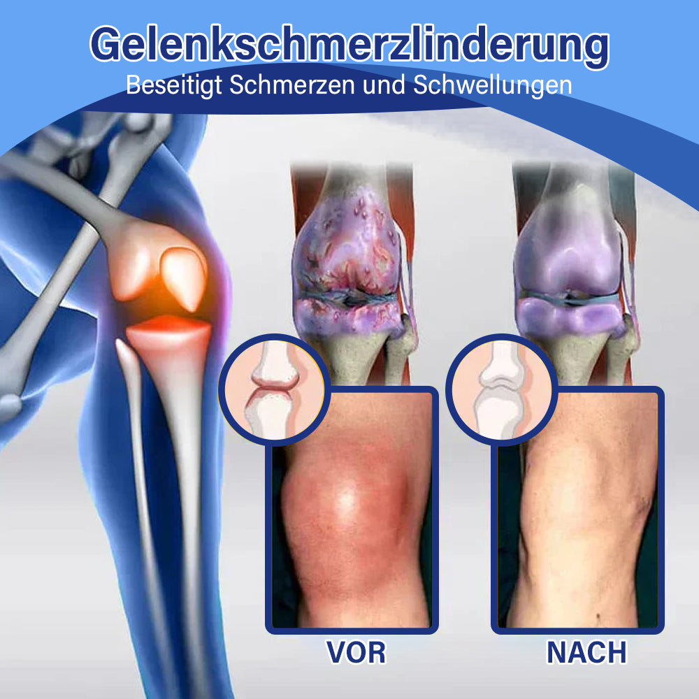 ✅Offizieller Shop: flysmus™ Lidocain Sofortige Schmerzlinderung Heilende Flüssigkeit👨⚕️(BfArM) zertifiziert(Lindert Gelenkschmerzen, Schwellungen, Steifheit, Rötung, Wärme, Muskelkater und Gelenkermüdung)