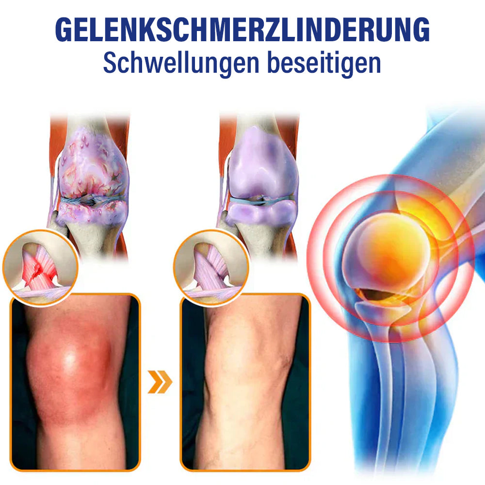 ✅Offizieller Shop: flysmus™ Lidocain Sofortige Schmerzlinderung Heilende Flüssigkeit👨⚕️(BfArM) zertifiziert(Lindert Gelenkschmerzen, Schwellungen, Steifheit, Rötung, Wärme, Muskelkater und Gelenkermüdung)