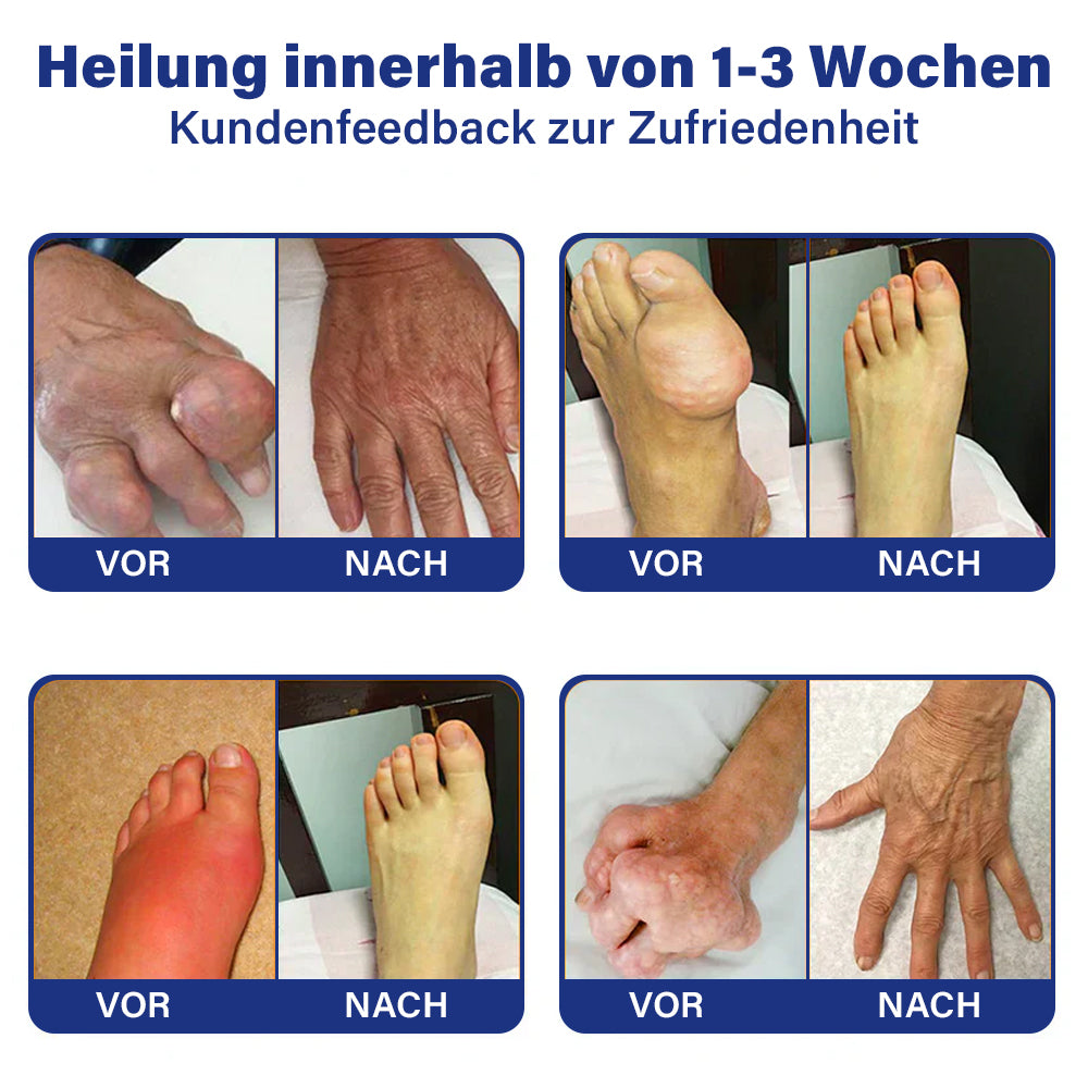✅Offizieller Shop: flysmus™ Lidocain Sofortige Schmerzlinderung Heilende Flüssigkeit👨⚕️(BfArM) zertifiziert(Lindert Gelenkschmerzen, Schwellungen, Steifheit, Rötung, Wärme, Muskelkater und Gelenkermüdung)