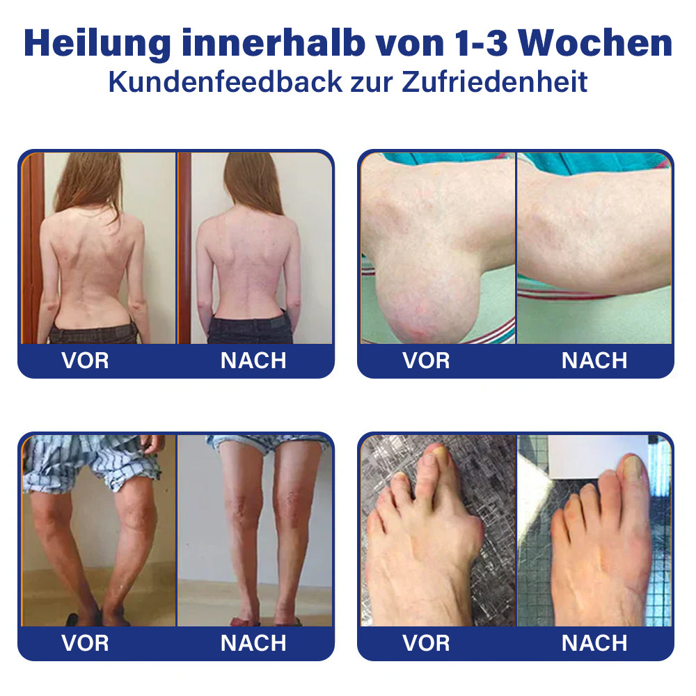 ✅Offizieller Shop: flysmus™ Lidocain Sofortige Schmerzlinderung Heilende Flüssigkeit👨⚕️(BfArM) zertifiziert(Lindert Gelenkschmerzen, Schwellungen, Steifheit, Rötung, Wärme, Muskelkater und Gelenkermüdung)