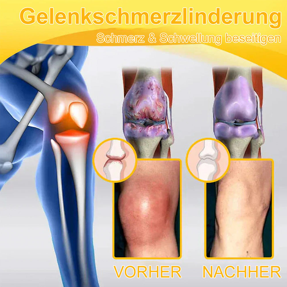 💧🐝Ourlyard™ Bienengift-Magnesium-Gelenkheilungcream👨‍⚕️(BfArM) zertifiziert(Lindert Nervenschäden, Muskelkrämpfe, Zuckungen und schlechte Knochengesundheit)