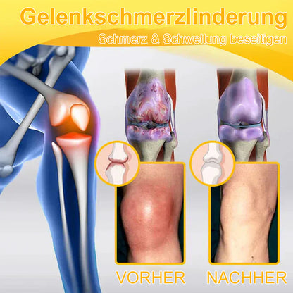 💧🐝Ourlyard™ Bienengift-Magnesium-Gelenkheilungcream👨‍⚕️(BfArM) zertifiziert(Lindert Nervenschäden, Muskelkrämpfe, Zuckungen und schlechte Knochengesundheit)