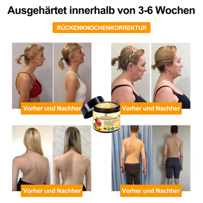 ✅ Offizieller Shop: flysmus™ Bienengift-Schmerzlinderungs Knochenheilungs Creme 👨‍⚕️(BfArM) Zertifizierungen(Reduzierung von Gelenkschwellungen, Schmerzen, Steifheit, Rötungen, Wärme, Muskelkater und Gelenkmüdigkeit)