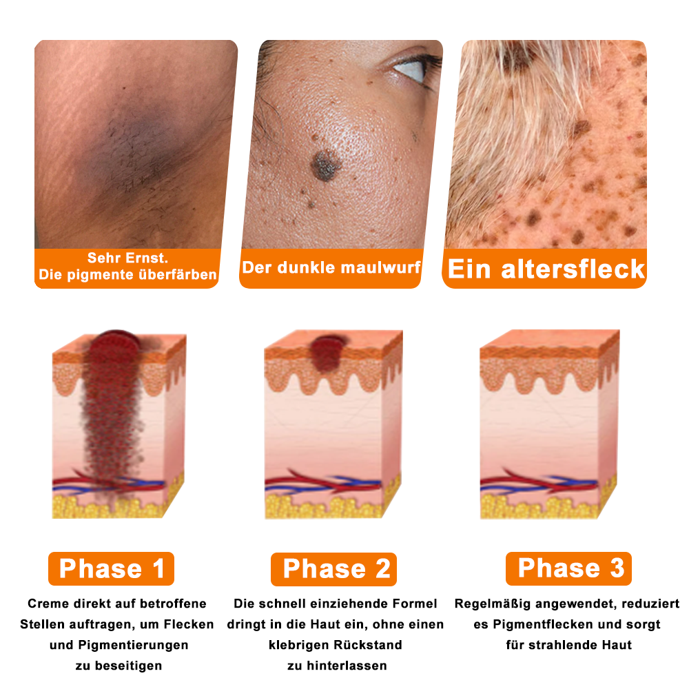 Offizieller Shop: Ourlyard® Bienengift Hautbehandlungscrem👨‍⚕️Von der Deutschen Gesellschaft für Dermatologie (DDG) genehmigt