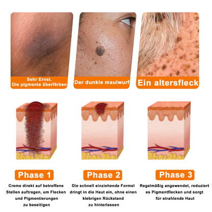 Offizieller Shop: Ourlyard® Bienengift Hautbehandlungscrem👨‍⚕️Von der Deutschen Gesellschaft für Dermatologie (DDG) genehmigt