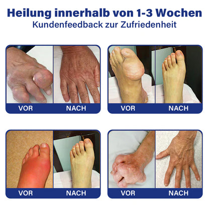 ✅Offizieller Shop: flysmus™ Lidocain Sofortige Schmerzlinderung Heilende Flüssigkeit👨‍⚕️(BfArM) zertifiziert(Lindert Gelenkschmerzen, Schwellungen, Steifheit, Rötung, Wärme, Muskelkater und Gelenkermüdung)