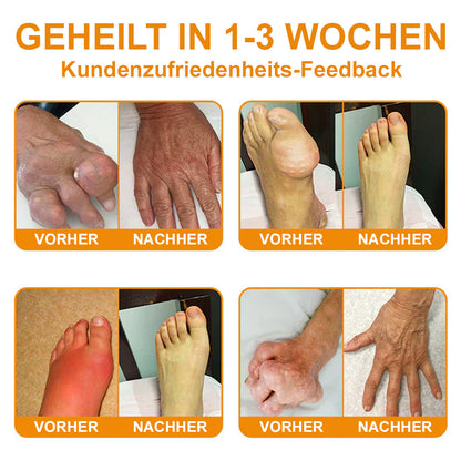 💧🐝Ourlyard™ Bienengift-Magnesium-Gelenkheilungcream👨‍⚕️(BfArM) zertifiziert(Lindert Nervenschäden, Muskelkrämpfe, Zuckungen und schlechte Knochengesundheit)