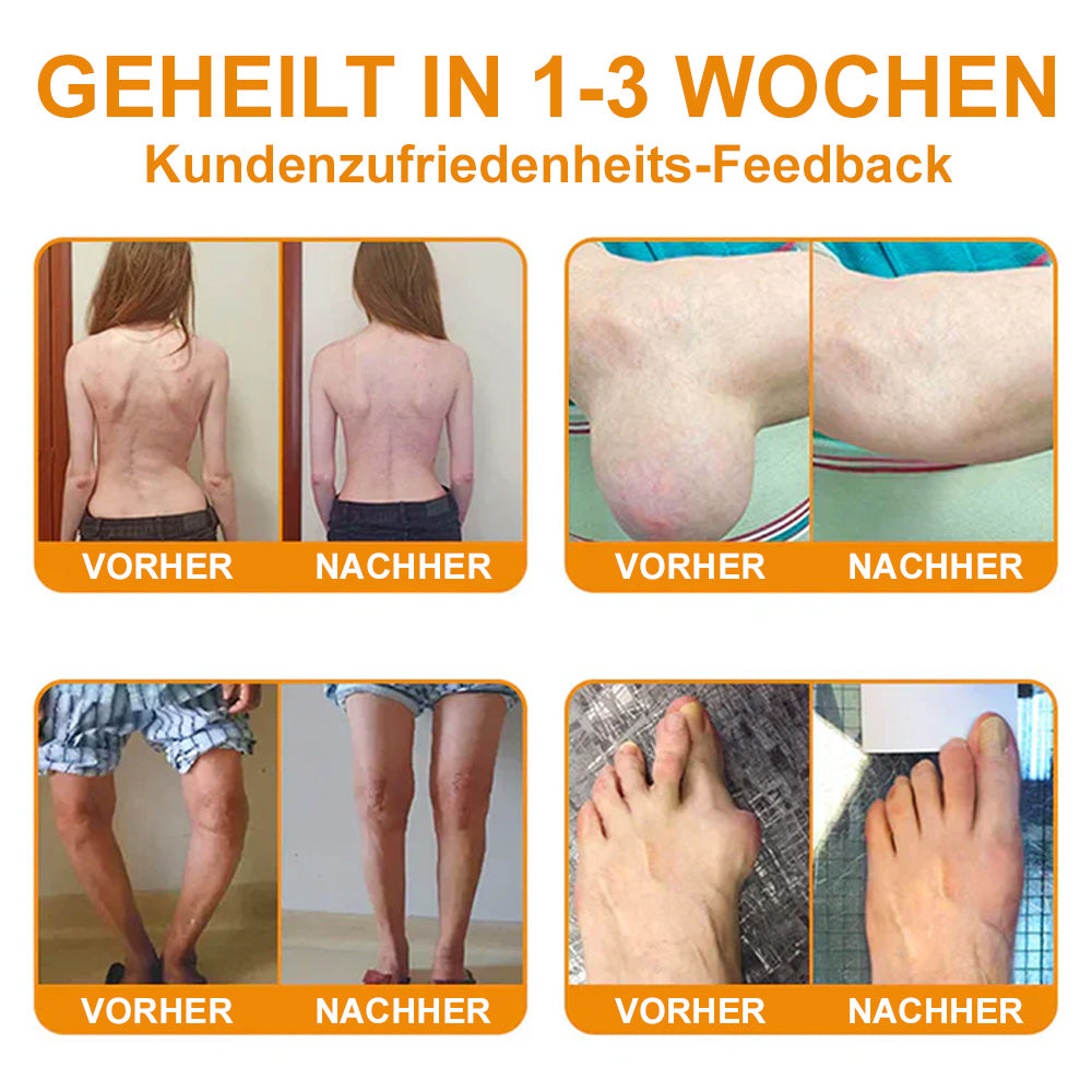 💧🐝Ourlyard™ Bienengift-Magnesium-Gelenkheilungcream👨‍⚕️(BfArM) zertifiziert(Lindert Nervenschäden, Muskelkrämpfe, Zuckungen und schlechte Knochengesundheit)