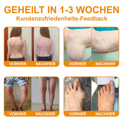 💧🐝Ourlyard™ Bienengift-Magnesium-Gelenkheilungcream👨‍⚕️(BfArM) zertifiziert(Lindert Nervenschäden, Muskelkrämpfe, Zuckungen und schlechte Knochengesundheit)