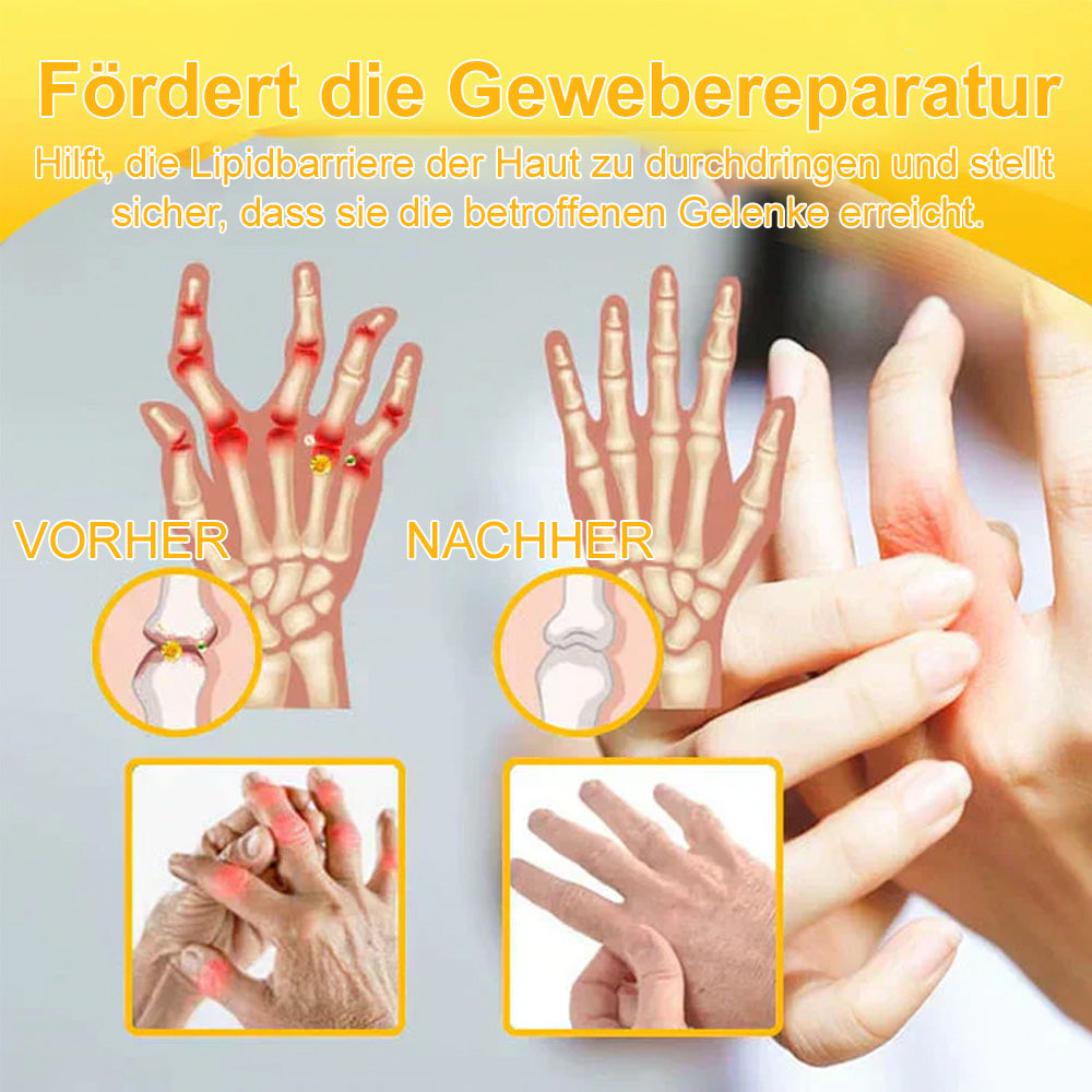 💧🐝Ourlyard™ Bienengift-Magnesium-Gelenkheilungcream👨‍⚕️(BfArM) zertifiziert(Lindert Nervenschäden, Muskelkrämpfe, Zuckungen und schlechte Knochengesundheit)
