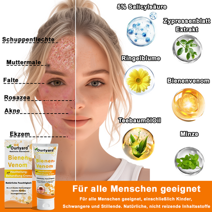Offizieller Shop: Ourlyard® Bienengift Hautbehandlungscrem👨‍⚕️Von der Deutschen Gesellschaft für Dermatologie (DDG) genehmigt